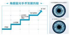 飞秒激光与普通近视手术的差异